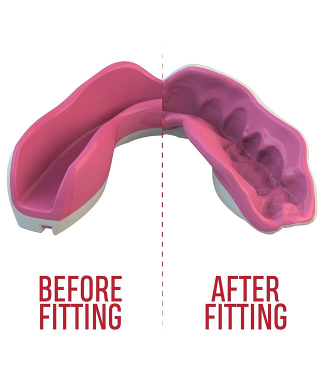 SAFEJAWZ® Extro Series Fangz Mouthguard Dracula White Pink - Kids