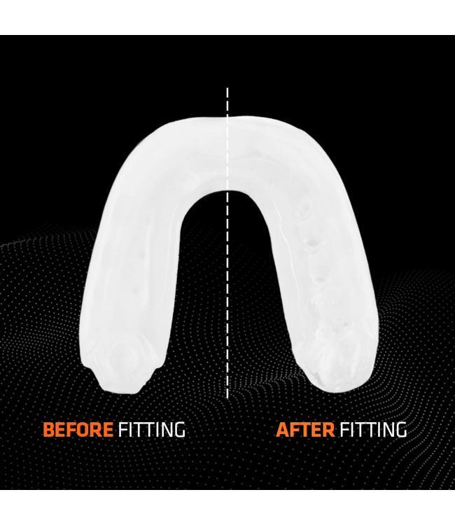 Shock Doctor Gel Max Mouthguard SDM‑1 – Gel‑Fit Liner (Adult) – White