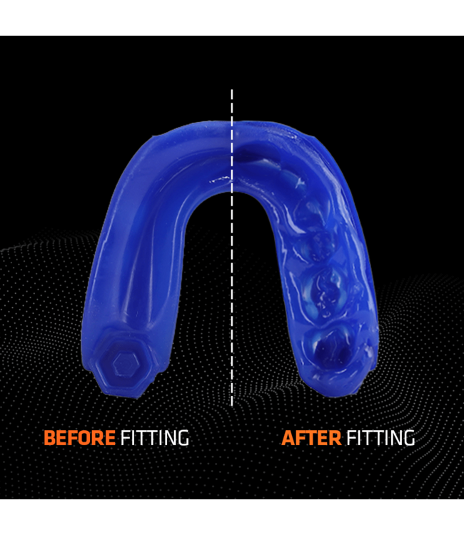 Shock Doctor Gel Max Mouthguard SDM‑1 – Gel‑Fit Liner (Adult) – Blue