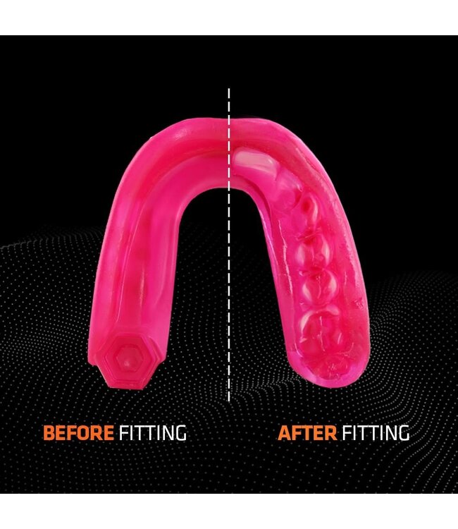 Shock Doctor Gel Max Mondbeschermer SDM‑1 – Gel‑Fit Liner (Volwassenen) – Roze