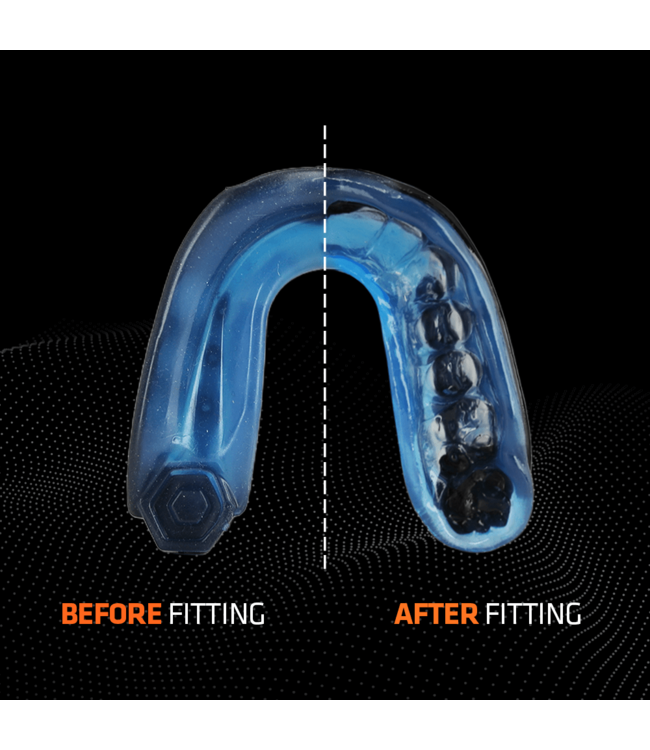 Shock Doctor Gel Max Mouthguard SDM‑1 – Gel‑Fit Liner (Adult) – Black Bleu