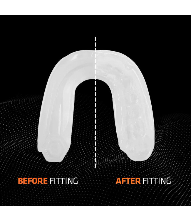 Shock Doctor Gel Max Mouthguard SDM‑1 – Gel‑Fit Liner (Adult) – Transparent