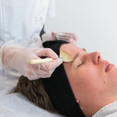 Peelings  huidtherapie vanaf