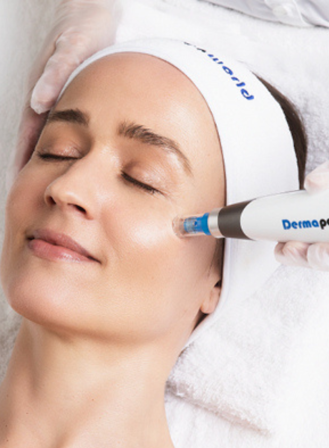 Dermapen4 Microneedling