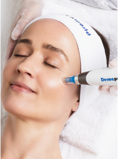 Dermapen4 Microneedling vanaf