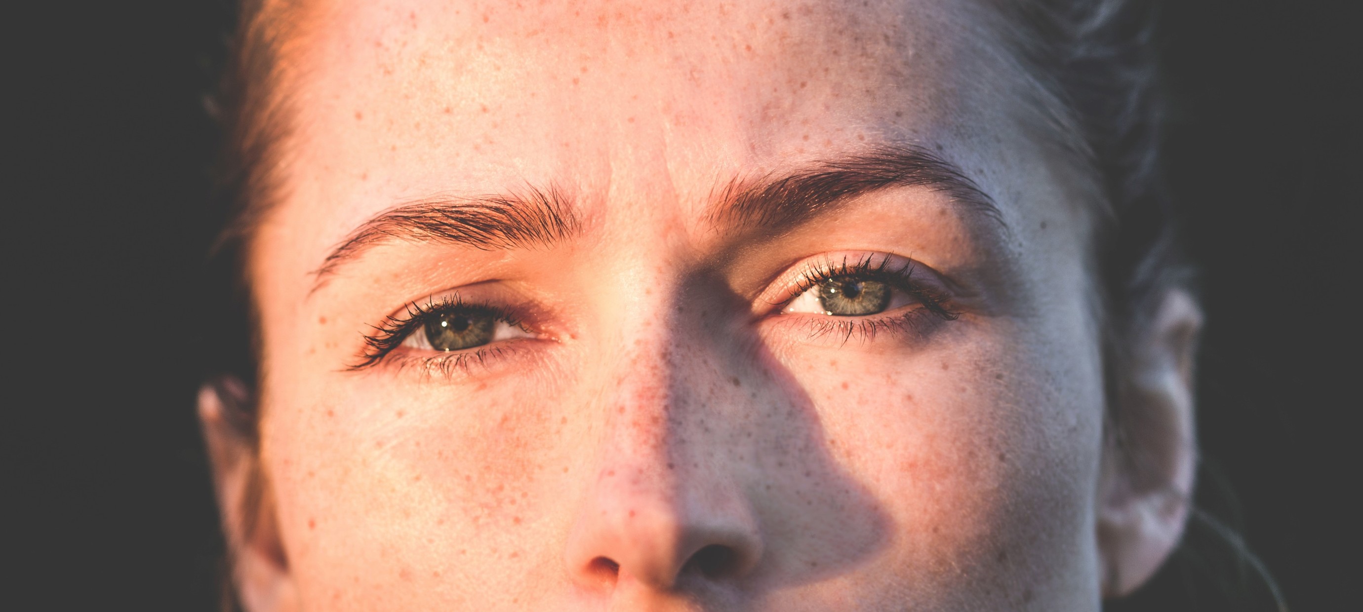 5 natural remedies for dark circles