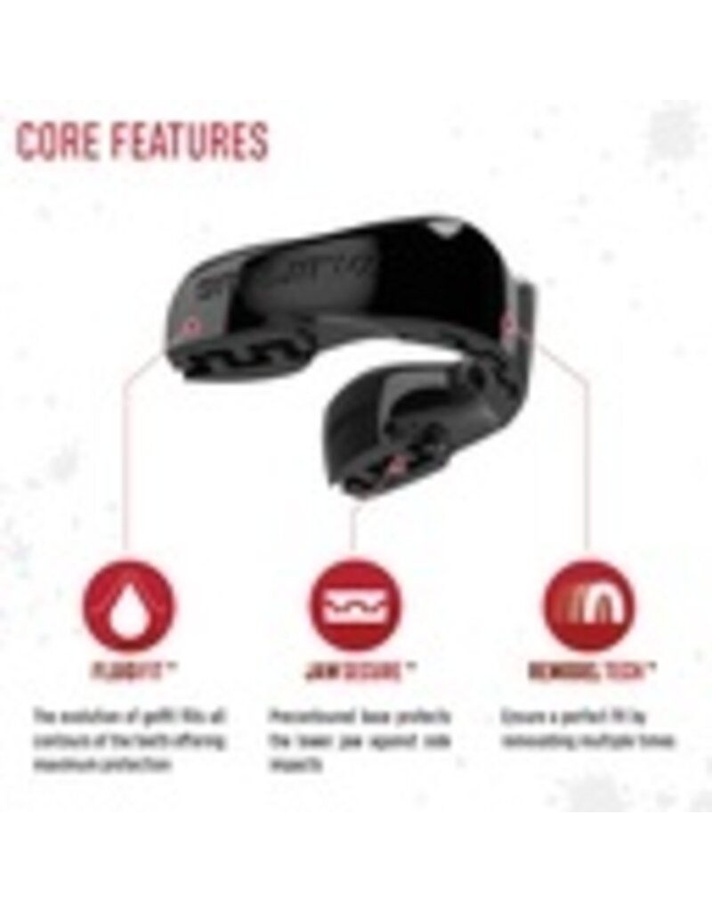 Mouthguard Intro Series