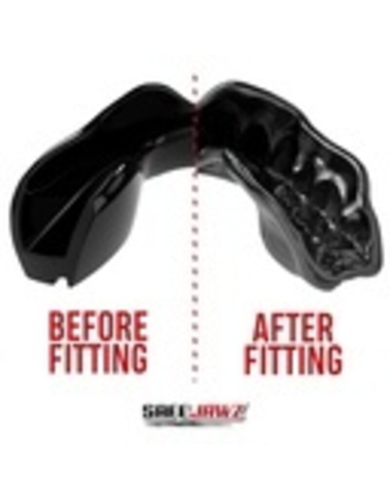 Mouthguard Intro Series