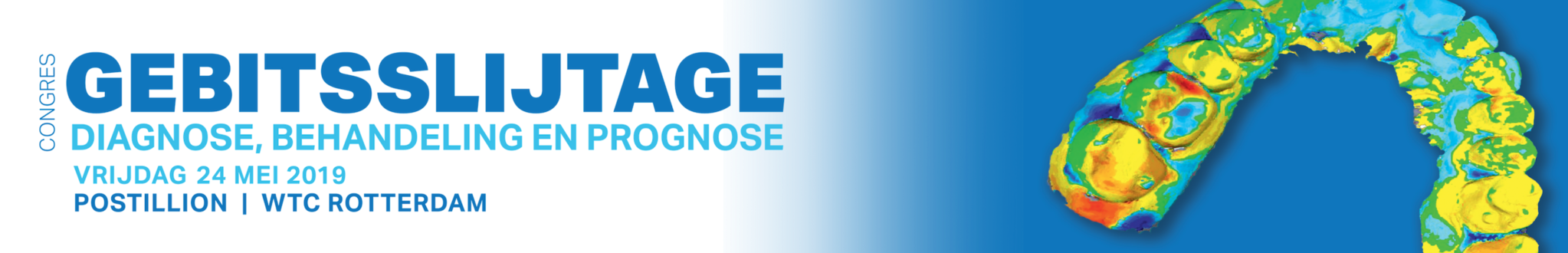 Dental Supply op TP Congres Gebitsslijtage