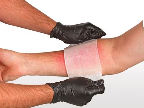 BurnTec Dressing 4"x 4" (10x10cm)