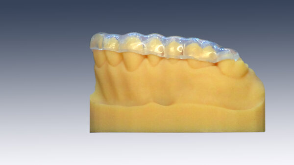 SleepPro Bleaching Schiene auf Maß SleepPro Bleaching Schiene auf Maß