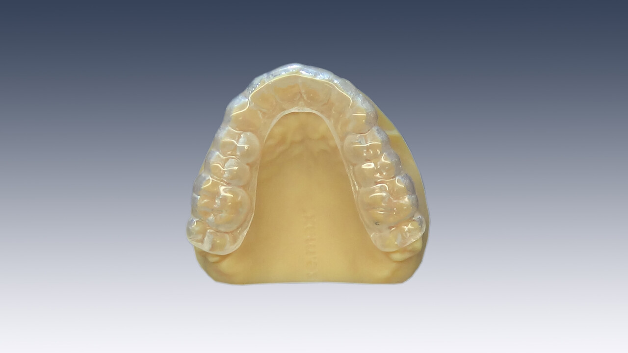 SleepPro Retainer Zahnschiene nach Maß (Nachtschiene) SleepPro Retainer Zahnschiene nach Maß (Nachtschiene)