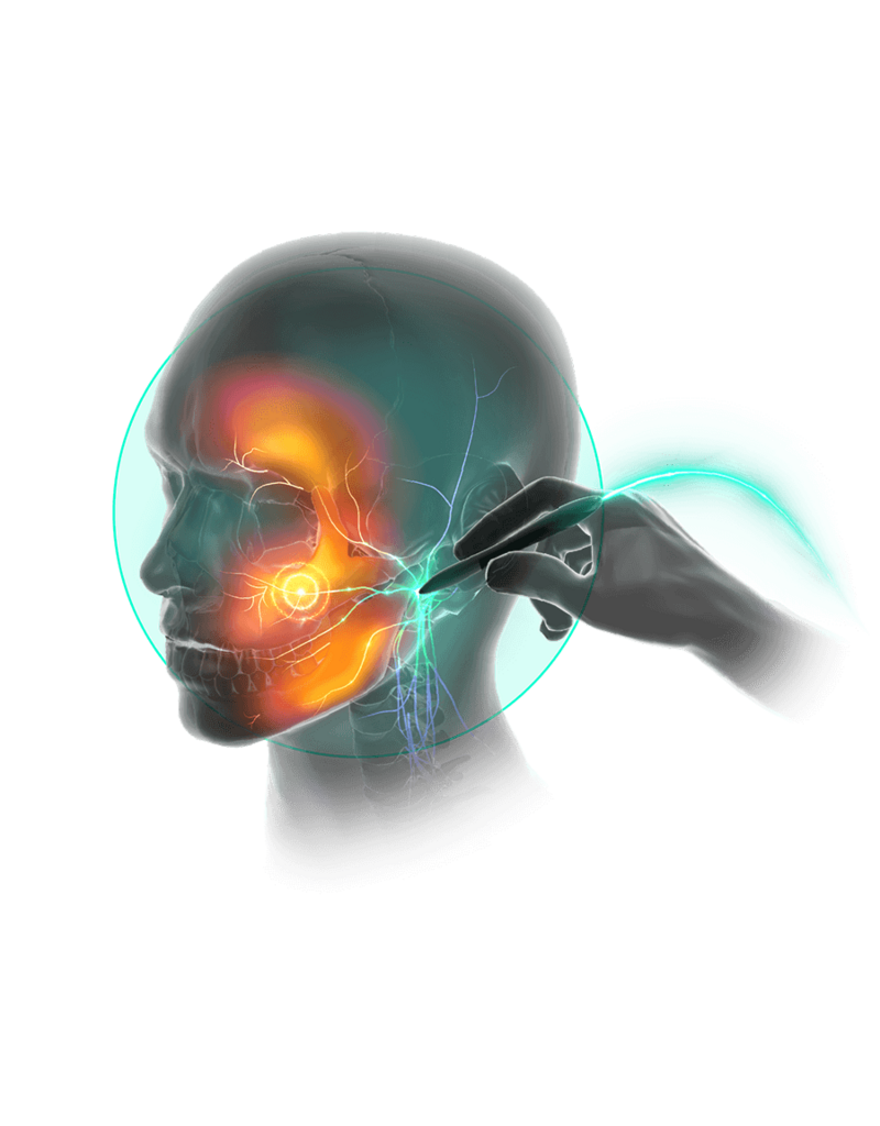 Algiamed Sistema de tratamiento del dolor crónico Stimpod