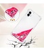 SoFetch Magenta Glitters TPU Hoesje voor de Nothing Phone (1)