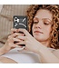 SoFetch SoFetch Zwart Carbontextuur TPU Hoesje voor de Nothing Phone (2)