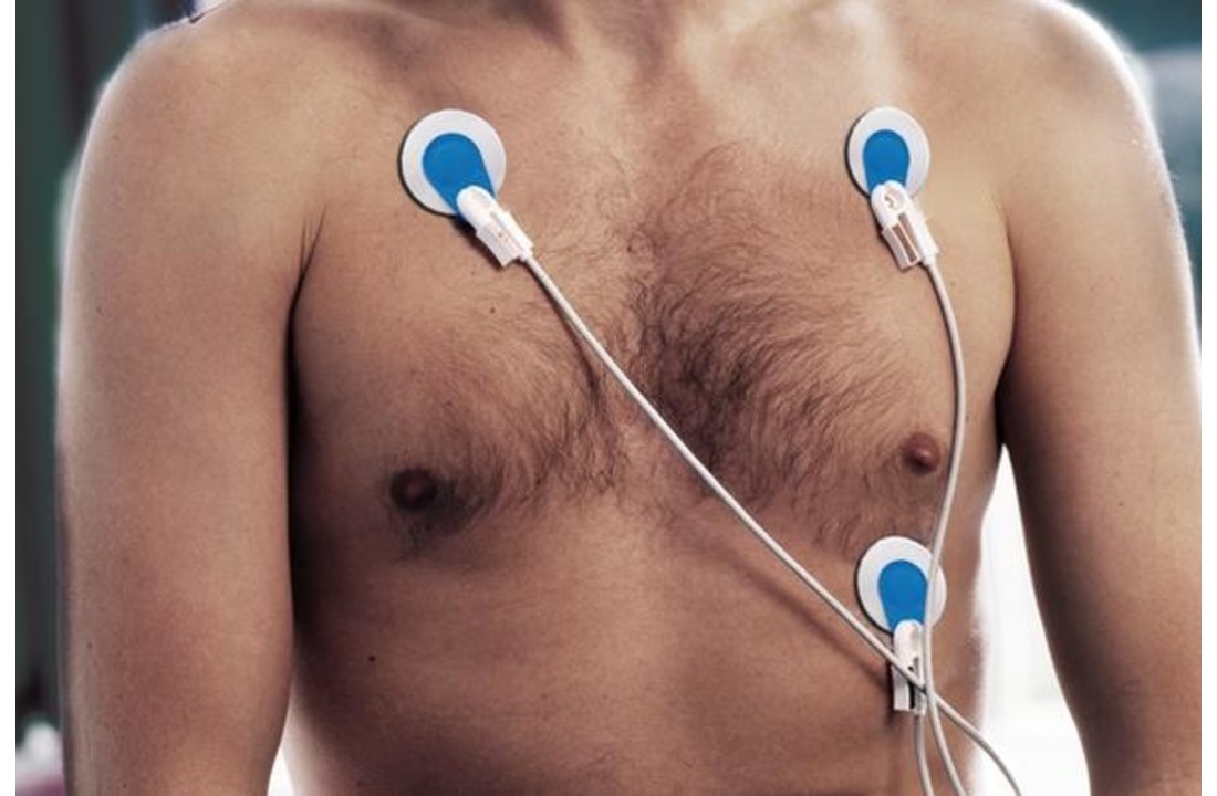Ambu BlueSensor R ECG elektroden(25 stuks)