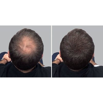 Hair Sculptor Fibras para el crecimiento del cabello color castaño oscuro, 25 gramos