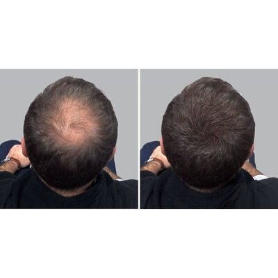 Hair Sculptor Fibras para dar volumen al cabello, color marrón oscuro, ¡paquete económico de 3 x 25 gramos!