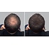 Hair Sculptor Fibras para dar volumen al cabello, color marrón oscuro, ¡paquete económico de 3 x 25 gramos!
