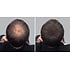 Hair Sculptor Hair Building Dark Brown Fibres, 3x25 gram VALUE PACK!