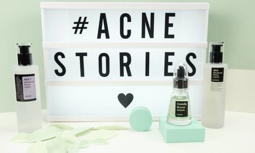 Acne stories - hoe kom je van je meeëters en onderhuidse puistjes af