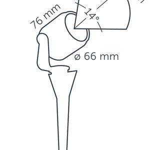 BIG SCOPE NARROW