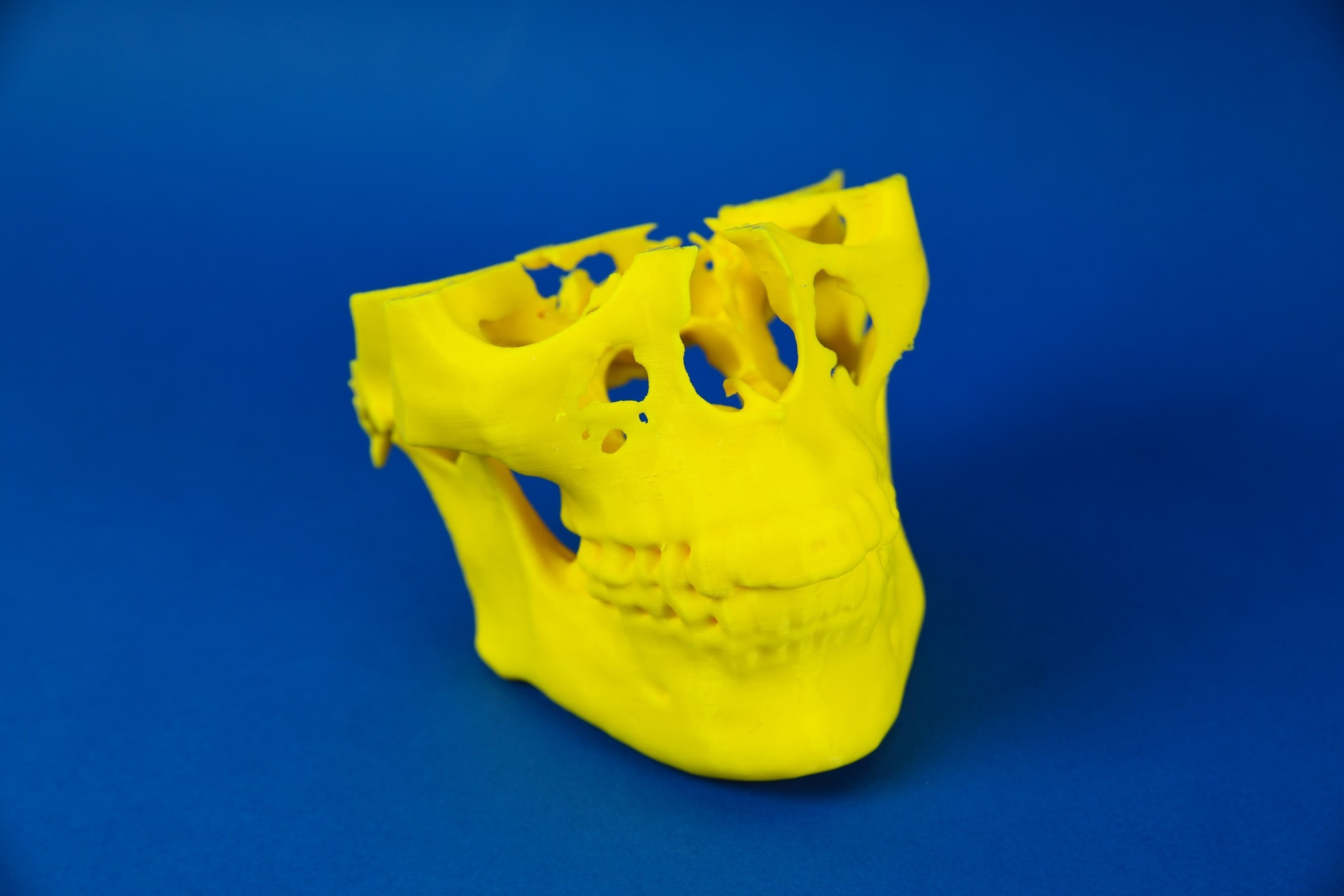 Entire Model (upper and lower jaws)