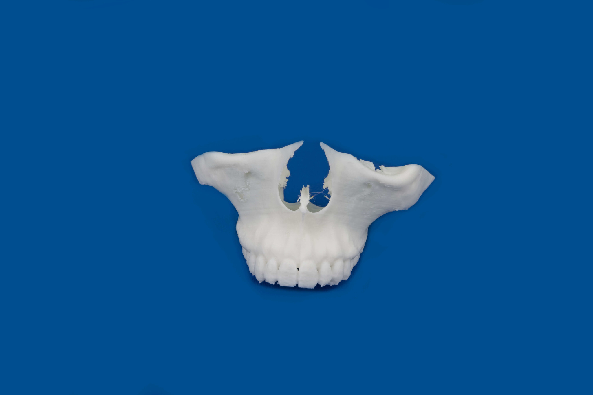 Modelo de mandíbula superior impreso en 3D