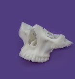 3D printed upper jaw model