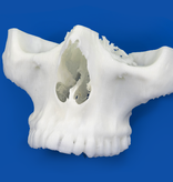 Package: 10 3D printed models in PLA from your CT/CBCT scan