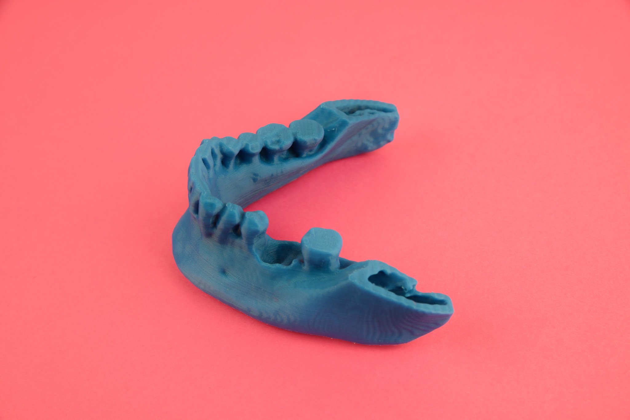 3D printed model from your DICOM files, lower or upper jaw using PLA