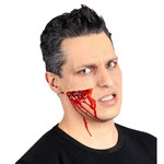 gapende wond,  professioneel