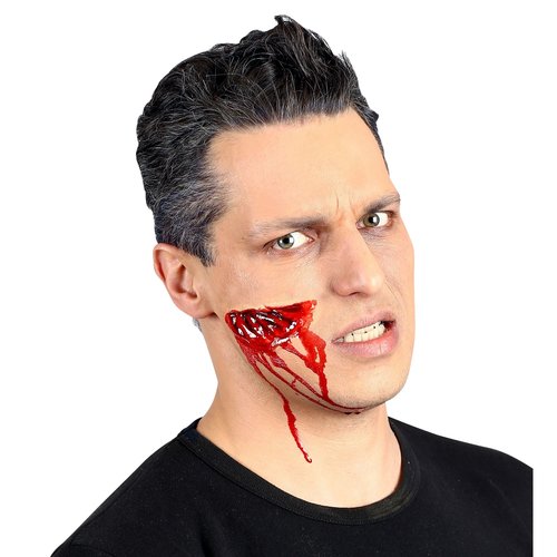 gapende wond,  professioneel