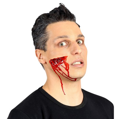 gapende wond,  professioneel