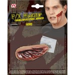 gapende wond,  professioneel