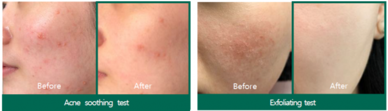 Some by Mi Some By Mi - AHA BHA PHA 30 Days Miracle Acne Clear Foam - 100 ml Some by Mi Some By Mi - AHA BHA PHA 30 Days Miracle Acne Clear Foam - 100 ml