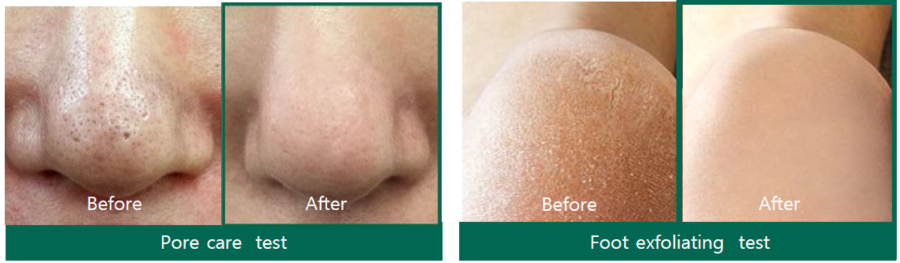 Some by Mi Some By Mi - AHA BHA PHA 30 Days Miracle Acne Cleansing Bar 100 g Some by Mi Some By Mi - AHA BHA PHA 30 Days Miracle Acne Cleansing Bar 100 g