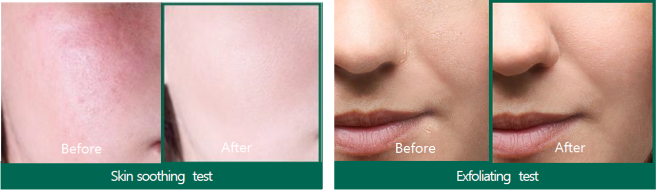 Some by Mi Some By Mi - AHA BHA PHA 30 Days Miracle Serum - 50ml Some by Mi Some By Mi - AHA BHA PHA 30 Days Miracle Serum - 50ml