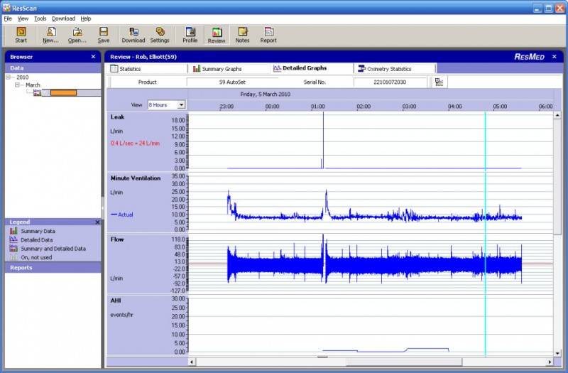 ResMed Resmed Resscan voor Resmed S8