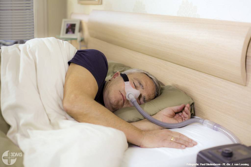 Aerafit Losse hoofdbandage voor het Aerafit gepersonaliseerd 3D geprint CPAP NOSE masker