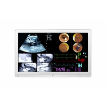 LG 32HL714S-W computer monitor 80 cm (31.5") 3840 x 2160 Pixels 4K Ultra HD Wit