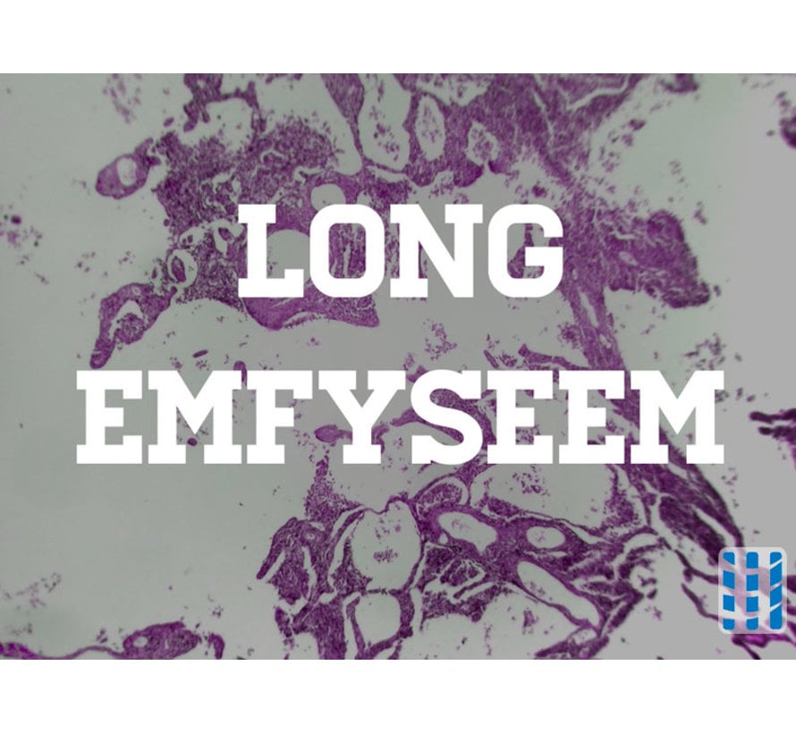 alpha-1 Antitrypsin lung and liver