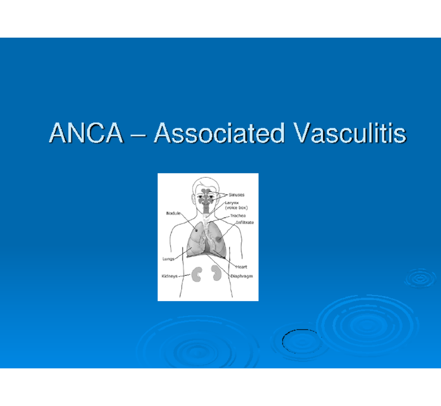 ANCA Anti-neurotrophic cytoplasmic antibodies