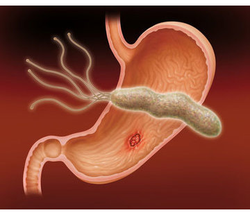 Helicobacter Pylori Bloed