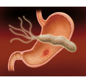 Helicobacter Pylori Bloed