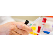 orderkosten en bloedafname op prikpost