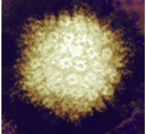 Varizella zoster virus? Am I immune?