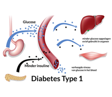 antibodies to insulin