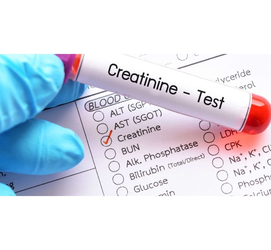 Creatinine Kreatinine in bloed nierfunctie