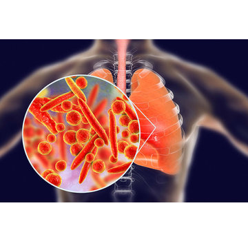 Mycoplasma pneumoniae